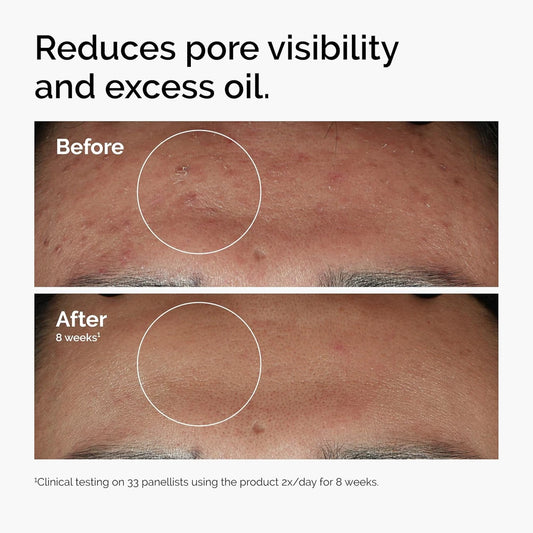 Niacinamide Zinc Smoothing Serum